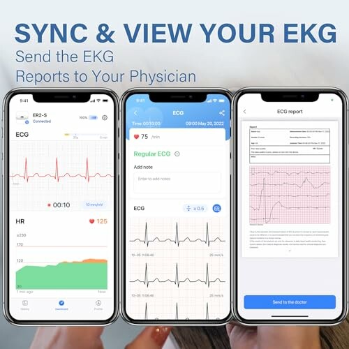 Drei Smartphones mit EKG-Berichten auf dem Bildschirm.